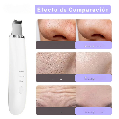 Limpiador Ultrasónico MultiPeel Power